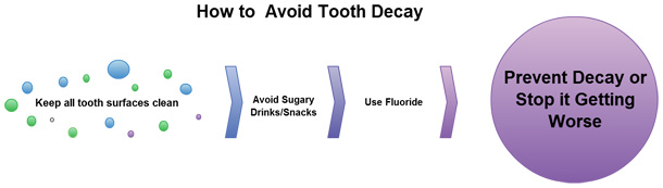 Avoiding Tooth Decay