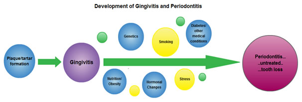 Gum Disease Diagram