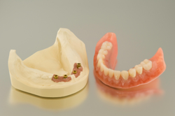 Four Implants
